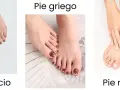 Tres tipos de forma de los pies: egipcio, griego y romano. Cada uno con dedos de diferente longitud.
