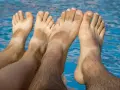 Pies bronceados con líneas blancas, indicando problemas de pie griego por el sol.