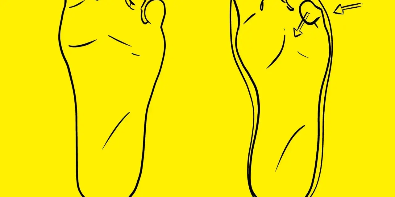 Dos pies dibujados en negro sobre fondo amarillo. Uno muestra el pie normal, el otro el pie con el segundo dedo más largo, el llamado dedo griego.