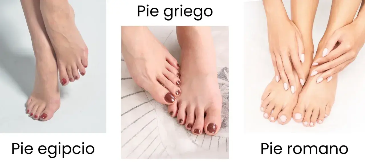 Tres tipos de forma de los pies: egipcio, griego y romano. Cada uno con dedos de diferente longitud.