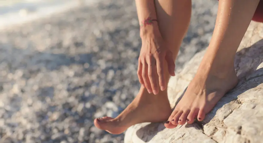 Pies con dishidrosis, con pequeñas ampollas visibles, descansando sobre rocas en la playa.