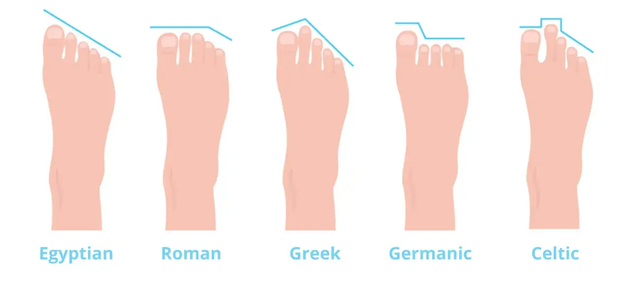 Cinco tipos de forma de los pies: egipcio, romano, griego, germánico y celta, cada uno con una silueta de dedos distinta.